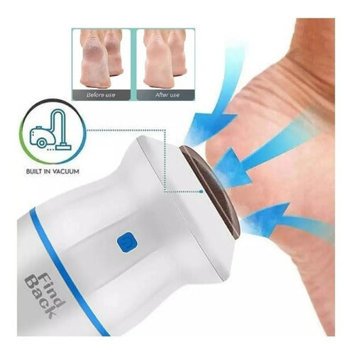 Removedor Durezas Eléctrico De Pies Quita Callos Usb/pilas